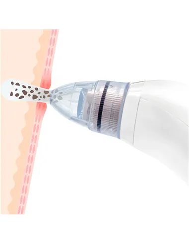 A Tres Click | Extractor De Espinillas XN -8030 / Acné $&nbsp;41.286 $&nbsp;24.286 Generic Kits de Limpieza 